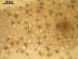 7 - Cellule stellate della zona midollare
